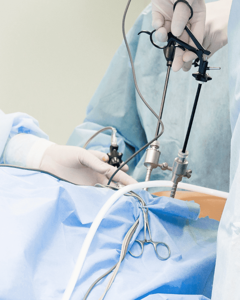 cirugia laparoscopica cdmx